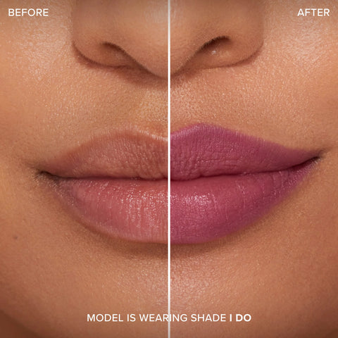 Lip Injection Extreme Lip Shaper
