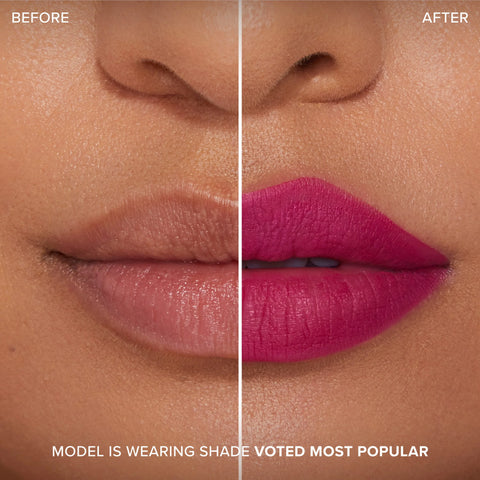 Lip Injection Extreme Lip Shaper