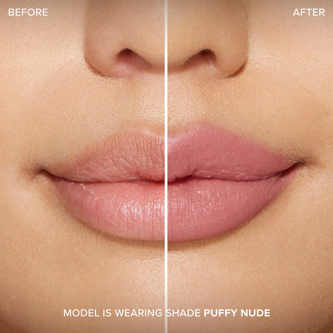 Lip Injection Extreme Lip Shaper